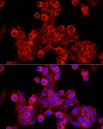 Anti-Sec24C antibody used in Immunocytochemistry/ Immunofluorescence (ICC/IF). GTX05064