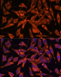 Anti-MT-ND1 antibody used in Immunocytochemistry/ Immunofluorescence (ICC/IF). GTX05066