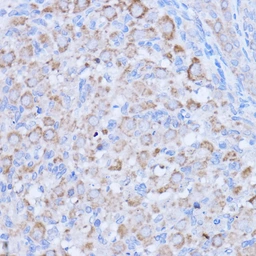 Anti-MT-ND1 antibody used in IHC (Paraffin sections) (IHC-P). GTX05066