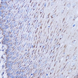 Anti-MT-ND1 antibody used in IHC (Paraffin sections) (IHC-P). GTX05066