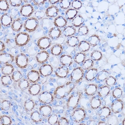 Anti-MT-ND1 antibody used in IHC (Paraffin sections) (IHC-P). GTX05066