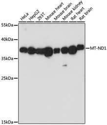 Anti-MT-ND1 antibody used in Western Blot (WB). GTX05066