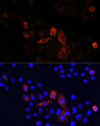 Anti-MT-ND2 antibody used in Immunocytochemistry/ Immunofluorescence (ICC/IF). GTX05067