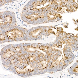 Anti-MT-ND2 antibody used in IHC (Paraffin sections) (IHC-P). GTX05067