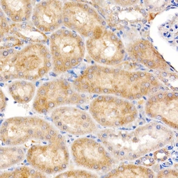 Anti-ND4 antibody used in IHC (Paraffin sections) (IHC-P). GTX05068