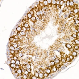 Anti-ND4 antibody used in IHC (Paraffin sections) (IHC-P). GTX05068