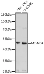 Anti-ND4 antibody used in Western Blot (WB). GTX05068