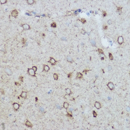 Anti-COX2 antibody used in IHC (Paraffin sections) (IHC-P). GTX05069