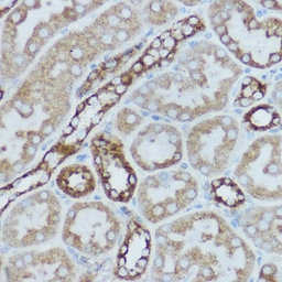 Anti-COX2 antibody used in IHC (Paraffin sections) (IHC-P). GTX05069
