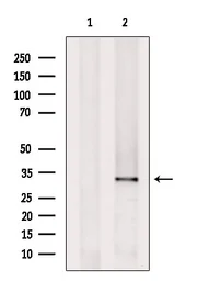 Anti-MTCO3 antibody used in Western Blot (WB). GTX05070