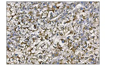 Anti-MERTK antibody used in IHC (Paraffin sections) (IHC-P). GTX05072