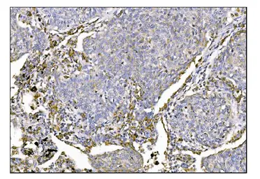 Anti-MERTK antibody used in IHC (Paraffin sections) (IHC-P). GTX05072