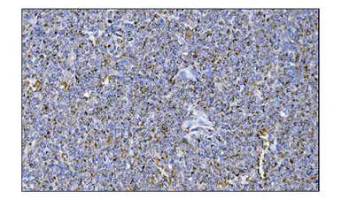 Anti-MERTK antibody used in IHC (Paraffin sections) (IHC-P). GTX05072