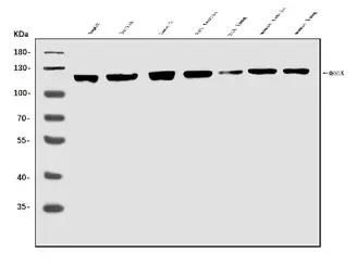 Anti-MERTK antibody used in Western Blot (WB). GTX05072
