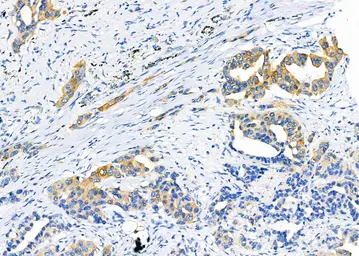 Anti-MMP11 antibody used in IHC (Paraffin sections) (IHC-P). GTX05076