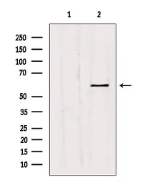 Anti-MMP11 antibody used in Western Blot (WB). GTX05076