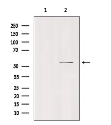 Anti-SLC16A5 antibody used in Western Blot (WB). GTX05079