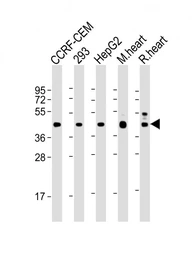 Anti-VEGFC antibody [197CT7.3.4] used in Western Blot (WB). GTX05081
