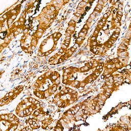 Anti-Caspase 12 antibody [ARC58203] used in IHC (Paraffin sections) (IHC-P). GTX05082