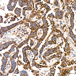 Anti-Caspase 12 antibody [ARC58203] used in IHC (Paraffin sections) (IHC-P). GTX05082
