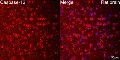 Anti-Caspase 12 antibody [ARC58203] used in IHC (Paraffin sections) (IHC-P). GTX05082