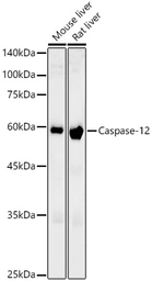 Anti-Caspase 12 antibody [ARC58203] used in Western Blot (WB). GTX05082
