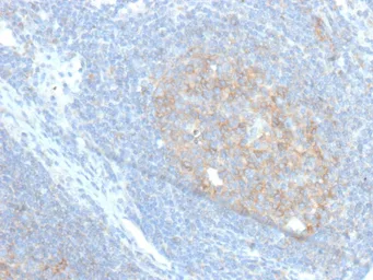 Anti-CD86 antibody [C86/6500R] used in IHC (Paraffin sections) (IHC-P). GTX05083