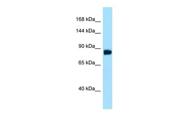 Anti-C11orf82 antibody used in Western Blot (WB). GTX05085