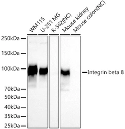 Anti-Integrin beta 8 antibody [ARC74019] used in Western Blot (WB). GTX05086