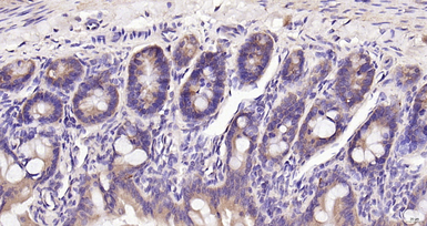 Anti-UGCG antibody used in IHC (Paraffin sections) (IHC-P). GTX05087
