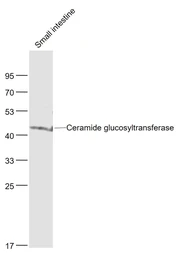 Anti-UGCG antibody used in Western Blot (WB). GTX05087
