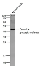 Anti-UGCG antibody used in Western Blot (WB). GTX05087