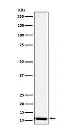 Anti-SPINK1 antibody [22S26] used in Western Blot (WB). GTX05088