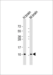 Anti-GNG2 antibody used in Western Blot (WB). GTX05089