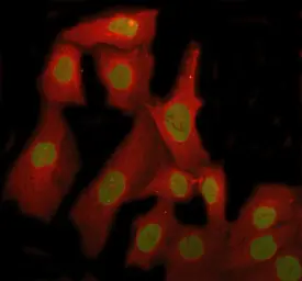 Anti-TAF15 antibody [27T75] used in Immunocytochemistry/ Immunofluorescence (ICC/IF). GTX05091
