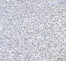 Anti-TAF15 antibody [27T75] used in IHC (Paraffin sections) (IHC-P). GTX05091