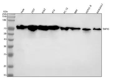 Anti-TAF15 antibody [27T75] used in Western Blot (WB). GTX05091