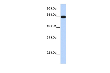 Anti-C16orf44 antibody used in Western Blot (WB). GTX05092