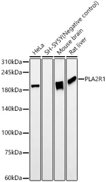 Anti-PLA2R1 antibody [ARC59749] used in Western Blot (WB). GTX05093