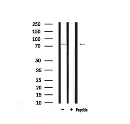 Anti-PKC gamma (phospho Thr514) antibody used in Western Blot (WB). GTX05095