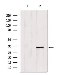 Anti-OVOL1 antibody used in Western Blot (WB). GTX05097