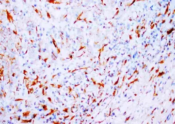 Anti-beta Tubulin antibody [TUB 2.1] used in IHC (Paraffin sections) (IHC-P). GTX05098