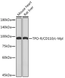 Anti-TPOR antibody [ARC2257] used in Western Blot (WB). GTX05100