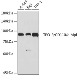 Anti-TPOR antibody [ARC2257] used in Western Blot (WB). GTX05100