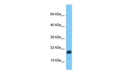 Anti-TEFM antibody used in Western Blot (WB). GTX05101