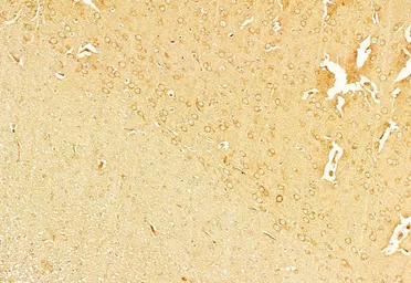 Anti-NLRP3 antibody used in IHC (Paraffin sections) (IHC-P). GTX05106