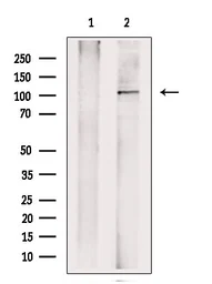 Anti-NLRP3 antibody used in Western Blot (WB). GTX05106