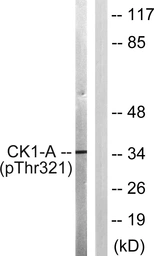 Anti-Casein Kinase 1 alpha (phospho Thr321) antibody used in Western Blot (WB). GTX05107