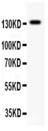 Anti-NMDAR2C antibody used in Western Blot (WB). GTX05110
