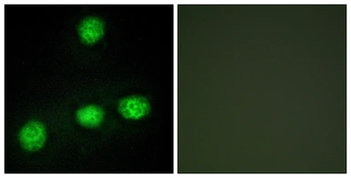 Anti-CLK1 antibody used in Immunocytochemistry/ Immunofluorescence (ICC/IF). GTX05111